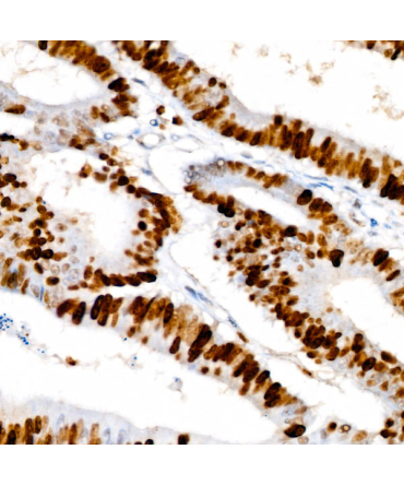 Ki67 Rabbit Monoclonal Antibody