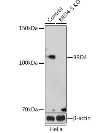 BRD4 Rabbit Polyclonal Antibody [KO Validated]