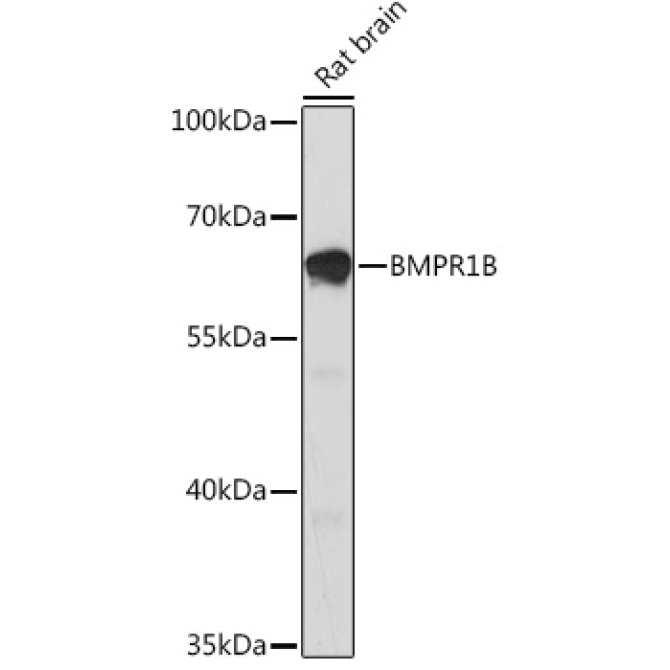 BMPR1B Rabbit Polyclonal Antibody