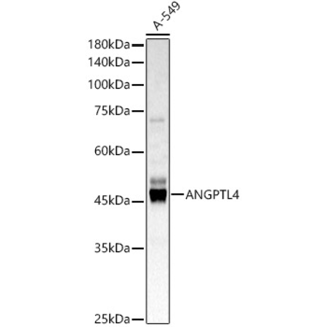 ANGPTL4 Rabbit Polyclonal Antibody