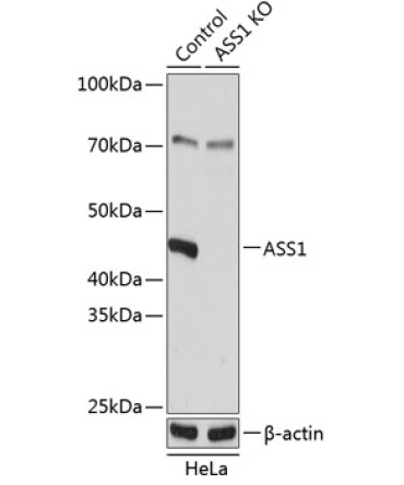 ASS1 Rabbit Polyclonal Antibody