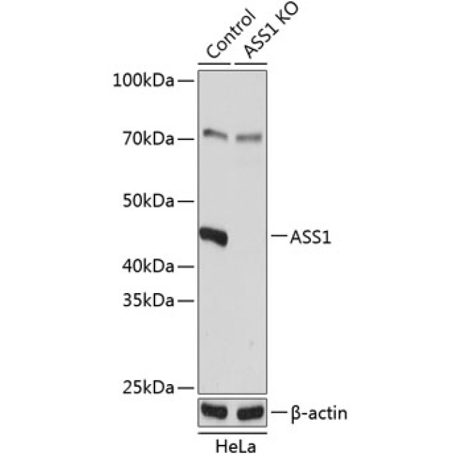 ASS1 Rabbit Polyclonal Antibody