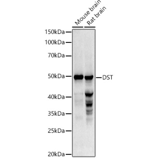 DST Rabbit Polyclonal Antibody