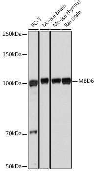 MBD6 Rabbit Polyclonal Antibody