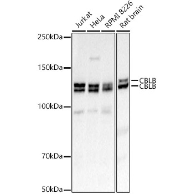CBLB Rabbit Polyclonal Antibody
