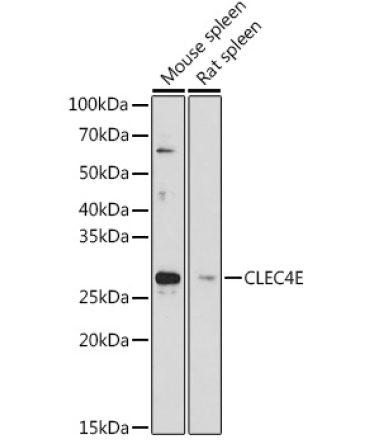 CLEC4E Rabbit Polyclonal Antibody