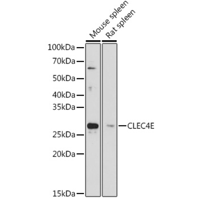 CLEC4E Rabbit Polyclonal Antibody