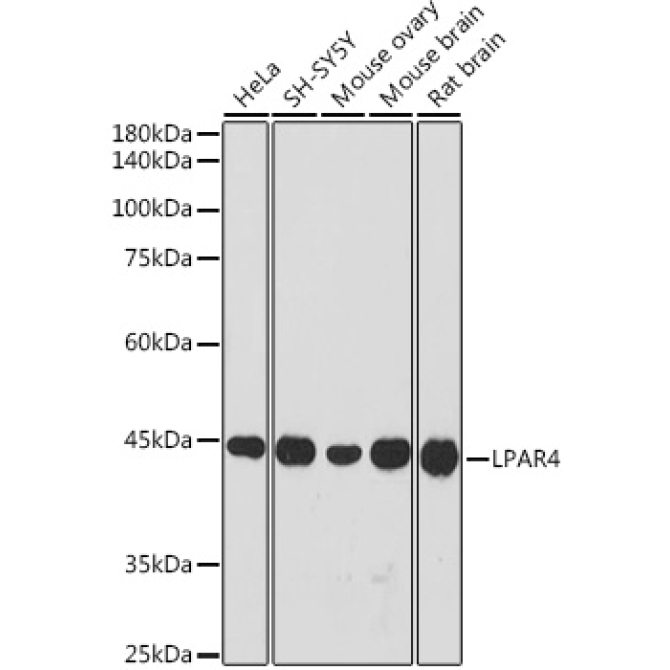 LPAR4 Rabbit Polyclonal Antibody