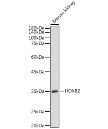 HOXB2 Rabbit Polyclonal Antibody