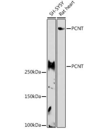PCNT Rabbit Polyclonal Antibody