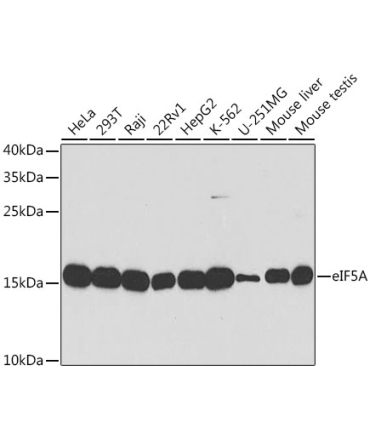 eIF5A Rabbit Polyclonal Antibody