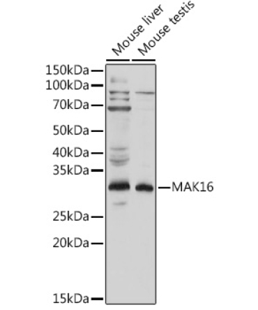 MAK16 Rabbit Polyclonal Antibody