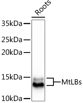 MtLBs Rabbit Polyclonal Antibody