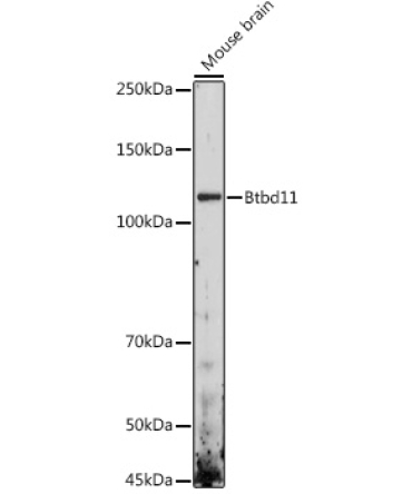Btbd11 Rabbit Polyclonal Antibody
