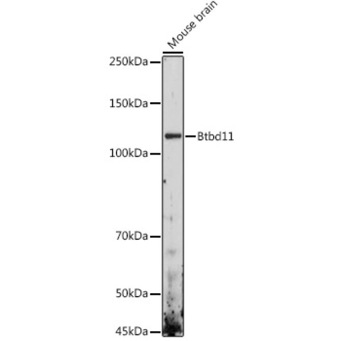 Btbd11 Rabbit Polyclonal Antibody
