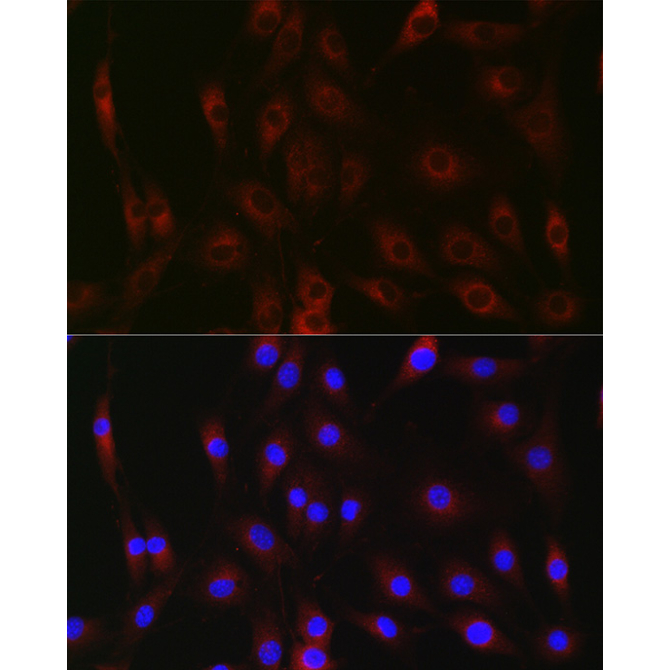 G6PC Rabbit Polyclonal Antibody