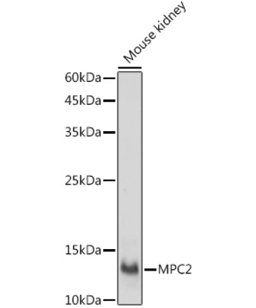 MPC2 Rabbit Polyclonal Antibody