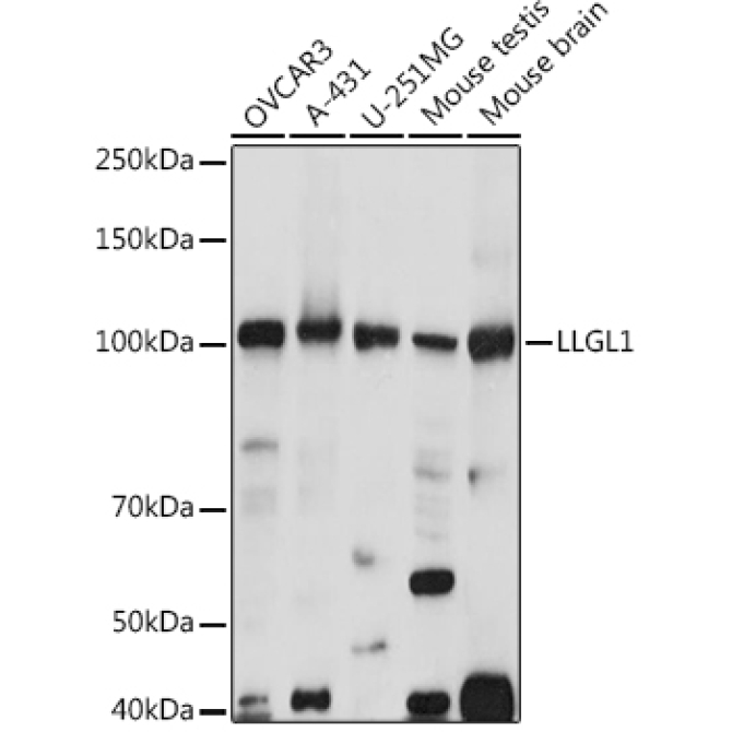 LLGL1 Rabbit Polyclonal Antibody
