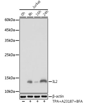 IL2 Rabbit Monoclonal Antibody