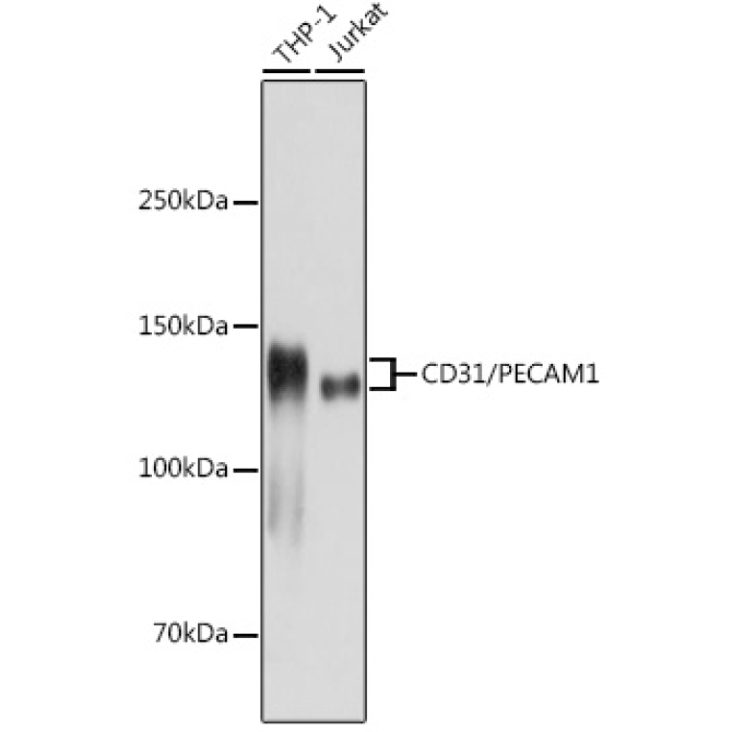 CD31/PECAM1 Rabbit Monoclonal Antibody