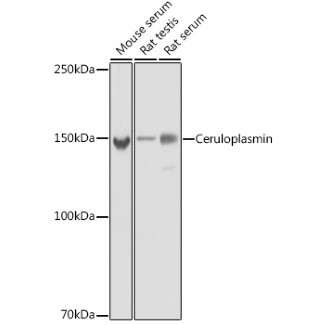 Ceruloplasmin Rabbit Monoclonal Antibody