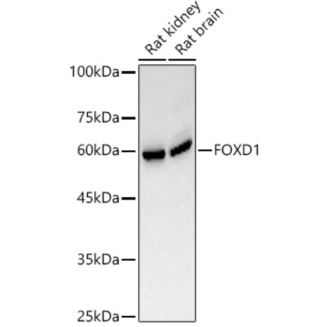 FOXD1 Rabbit Polyclonal Antibody