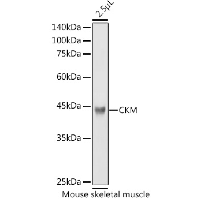 CKM Rabbit Polyclonal Antibody