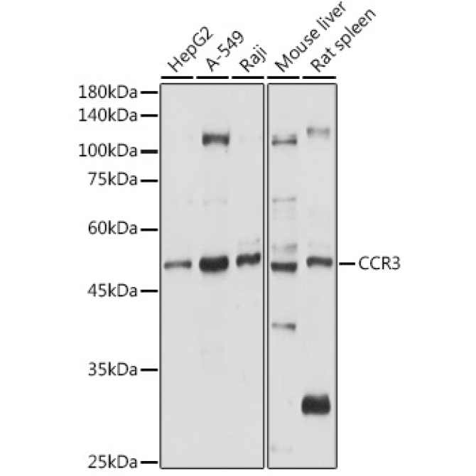 CCR3 Rabbit Polyclonal Antibody