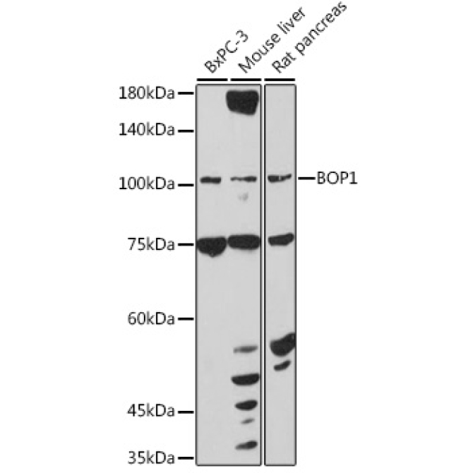 BOP1 Rabbit Polyclonal Antibody