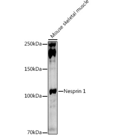 Nesprin 1 Rabbit Polyclonal Antibody