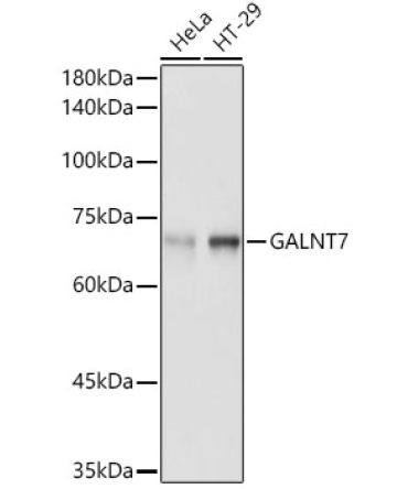 GALNT7 Rabbit Polyclonal Antibody