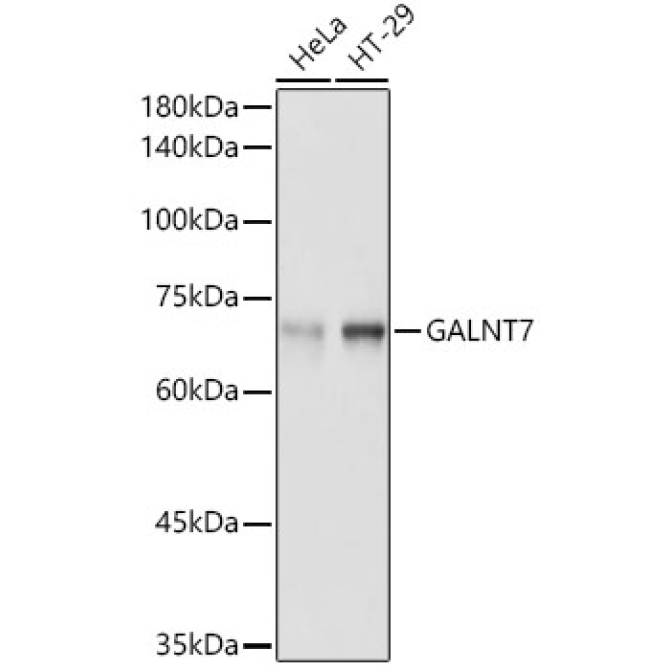 GALNT7 Rabbit Polyclonal Antibody