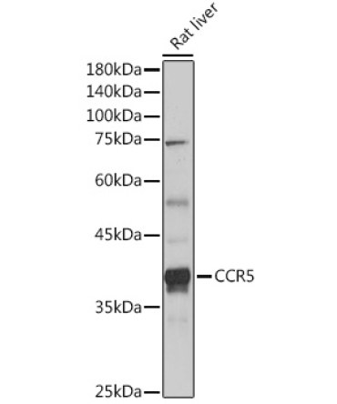 CCR5 Rabbit Polyclonal Antibody