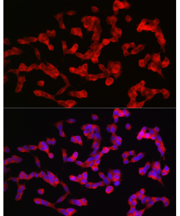 ANK3 Rabbit Polyclonal Antibody