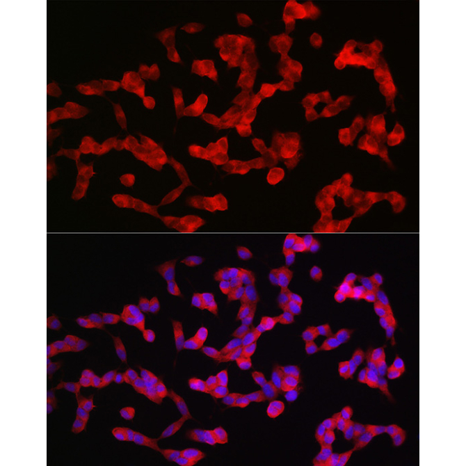 ANK3 Rabbit Polyclonal Antibody