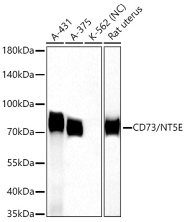 CD73/NT5E Rabbit Polyclonal Antibody