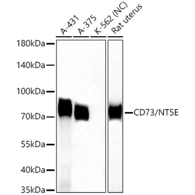 CD73/NT5E Rabbit Polyclonal Antibody