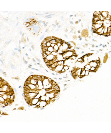 FXYD3 Rabbit Polyclonal Antibody