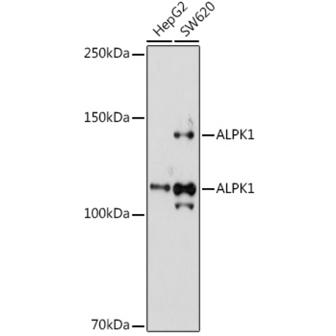 ALPK1 Rabbit Polyclonal Antibody