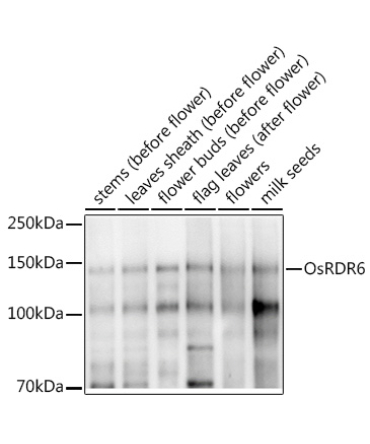 OsRDR6 Rabbit Polyclonal Antibody