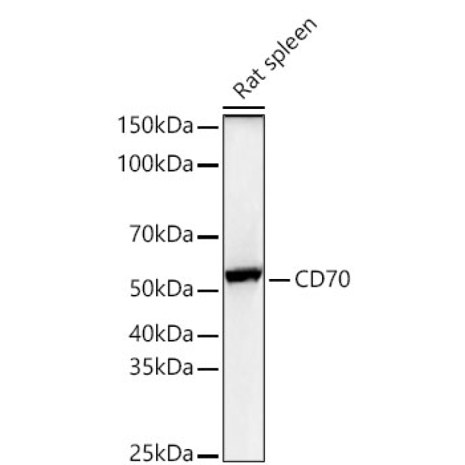 CD70 Rabbit Polyclonal Antibody