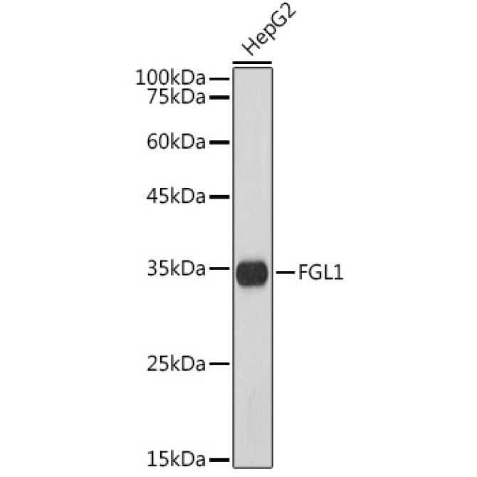 FGL1 Rabbit Monoclonal Antibody
