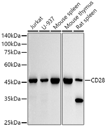 CD28 Rabbit Monoclonal Antibody