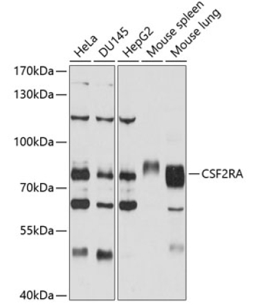 CSF2RA Rabbit Polyclonal Antibody