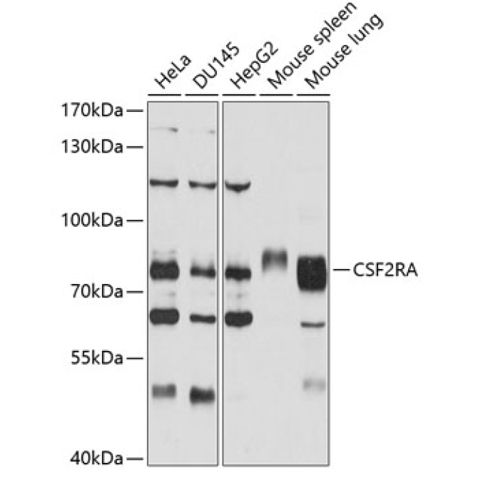 CSF2RA Rabbit Polyclonal Antibody