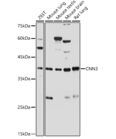 CNN3 Rabbit Polyclonal Antibody