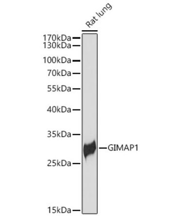 GIMAP1 Rabbit Polyclonal Antibody
