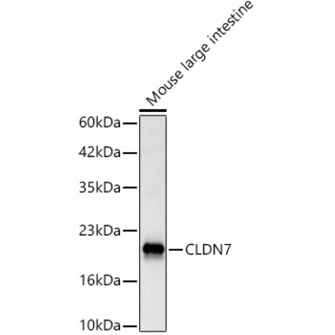 CLDN7 Rabbit Polyclonal Antibody