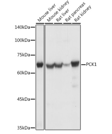 PCK1 Rabbit Polyclonal Antibody