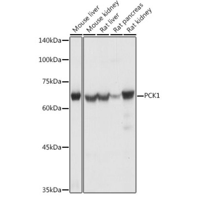 PCK1 Rabbit Polyclonal Antibody